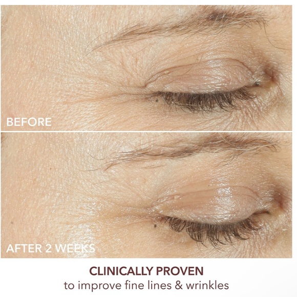 Dr. Dennis Gross triple correction eye serum - Picture 5 of 5